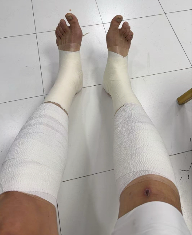 kaiyun.com-太硬了！翟晓川双腿缠满绷带罚球制胜 5人伤停许利民盛赞全队坚韧